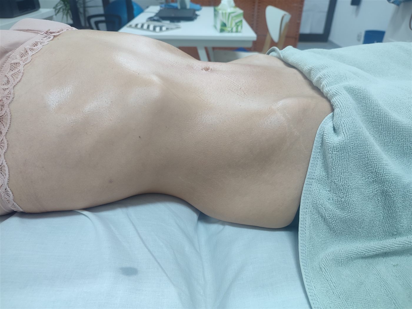 Lymphatic drainage for pregnancy